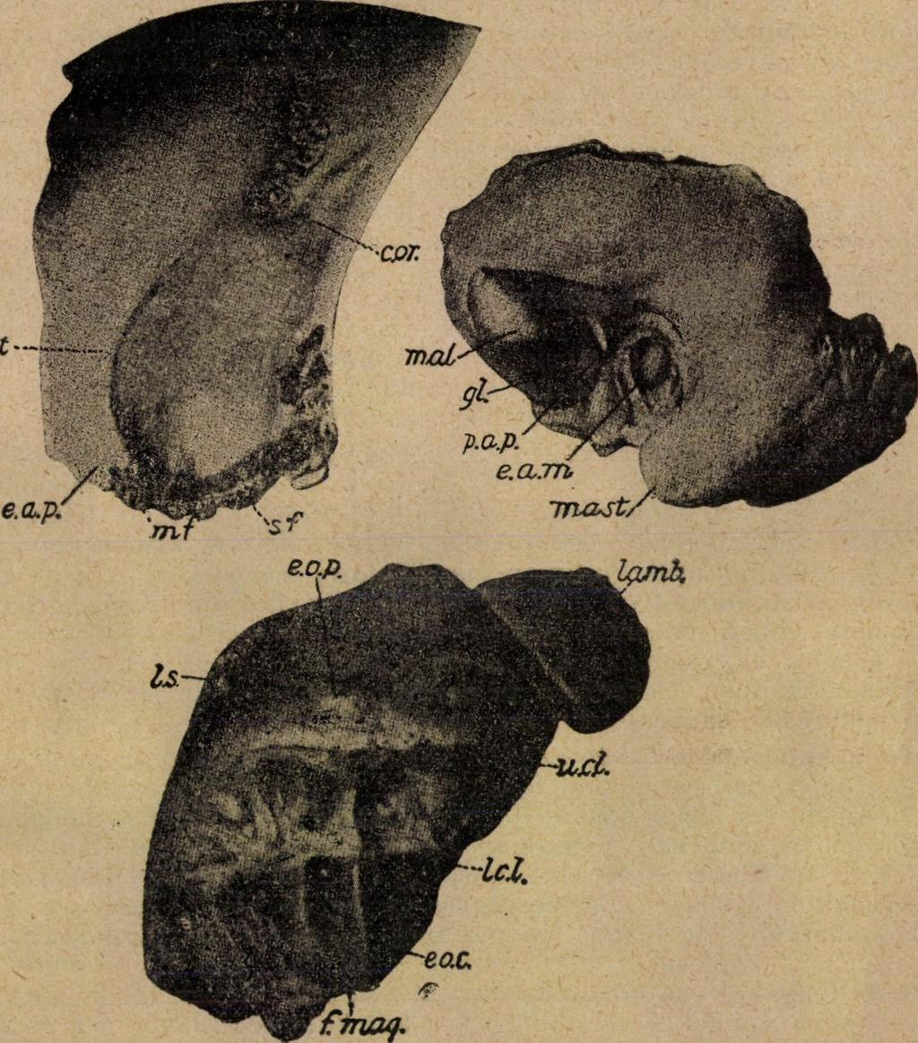 külső nyakszirti gumó (protuberantia occip. ext.); f. mag. öreglyuk (foramen magnum); lamb lambdavarrat ; 1. s. legfelső tarkóvonal (linea nuchae suprema) ; u. c. l. felső tarkóvonal (linea nuchae superior): I.
