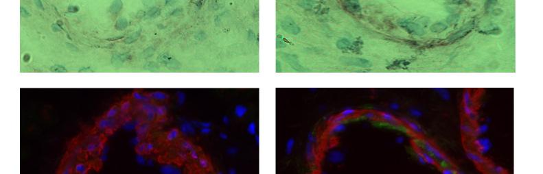 ábra). DM (-) DM (+) COX-2 (DAB-festés) COX-2 (zöld) SMA (piros) DAPI (kék) 50 µm 9.