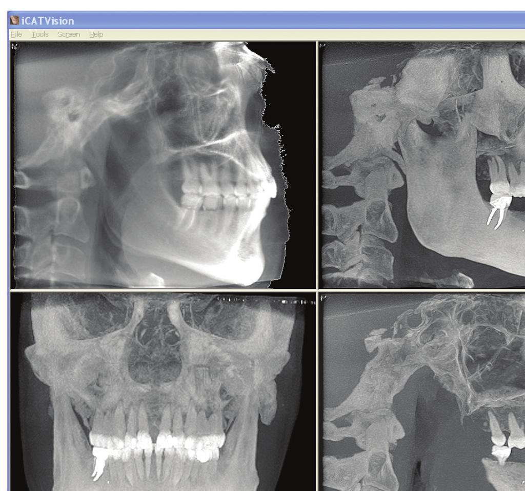 Ortho nézet Kattintson kétszer a