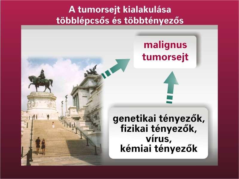 A karcinogenezis multifaktoriális