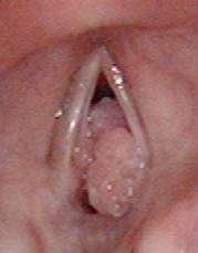 edu) 1 Photos courtesy of Craig S. Derkay, MD Eastern Virginia Medical School 1.