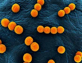 : bacitracin, karbadox, tylozin) hozamfokozóként való használatát az állattartásban, az emberi multirezisztens kórokozók (pl: MRSA, VRE) jelenléte azonban továbbra is emelkedik.