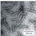 61 λ λ 2nm nsinα 2 Mikroszkópi technikák felbontása TIRFM, szuperrezolúciós mikroszkóp (+fluoreszcens jelzés) < 2 nm DNS-re