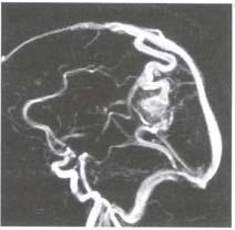 Az MRI mint diagnosztikai módszer De: - a készülék és a mérés drága - 3D képhez hosszú adatgyűjtési idő pszichológiai problémák -non-invasive módszer (de: kontrasztanyagok toxicitása?