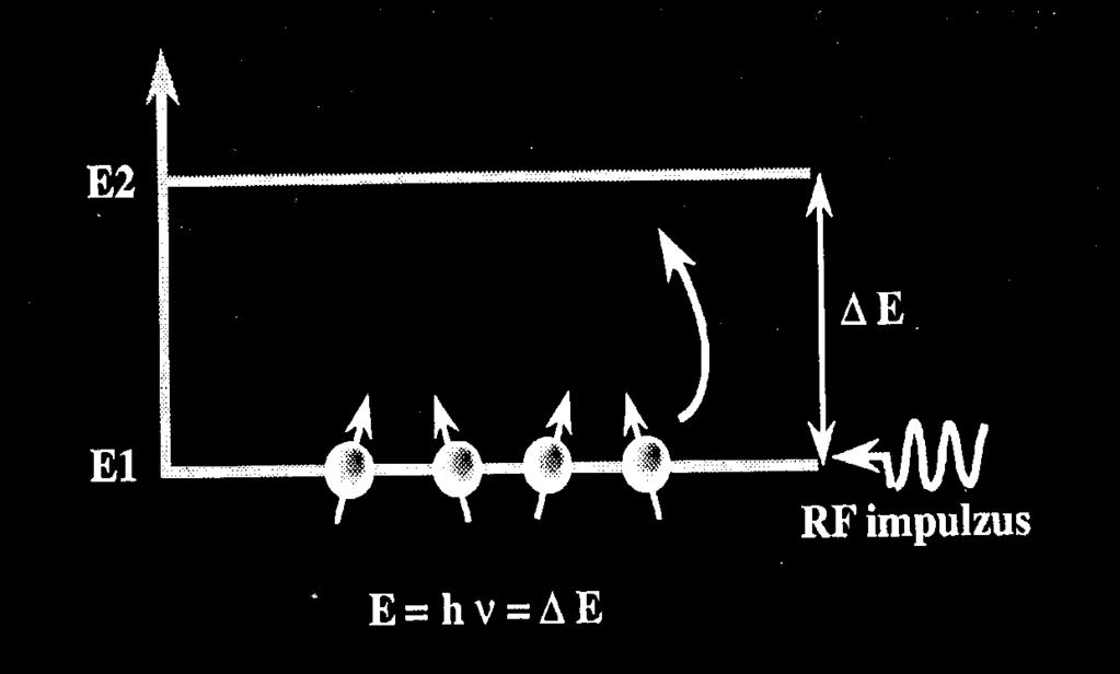 3. Megfelelő gerjesztési frekvenciájú sugárzás bekapcsolása: proton-mágneses rezonancia A gerjesztés hatása: Δ E = 2μB( z) = hf A
