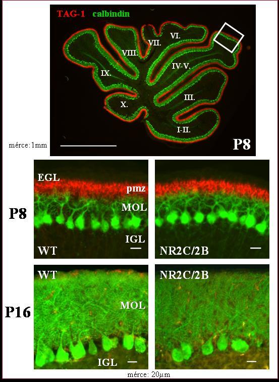 Golgi-impregnált Purkinje sejtek. 6. ábra. A primer (bal olda