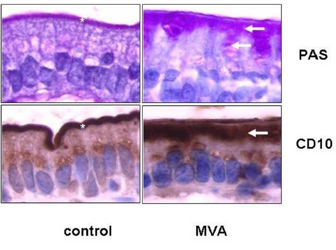 Congenitalis microvillus atrophia Kontrol MVA CD 10 = neutralis