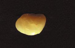 Yttriumoxiddal stabilizált Cirkonoxidok (3YTZP).