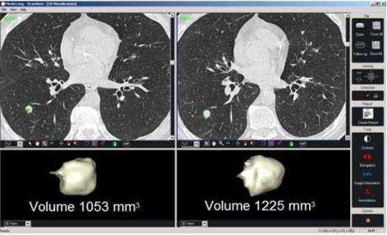 Diagnosztikai példák tumor viselkedésének