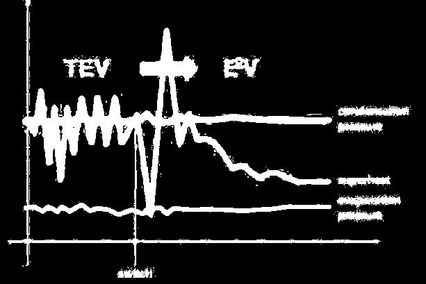 5 A működése a 4.ábra alapján követhető nyomon, összehasonlítva a termosztatikus expanziós szelepekkel (TEV). Ebből látható, hogy az EEV szelepek stabilan és min.