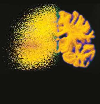Journal of Diabetes Research Hindawi Publishing