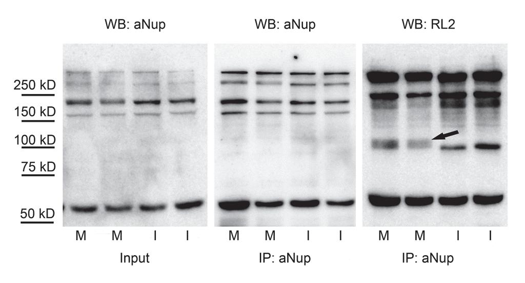 Molecules 2018, 23, 1275 6 of 16 Therefore, we collected several fractions of cells from synchronized cultures for protein isolation and O-GlcNAc detection in a time period overlapping the critical