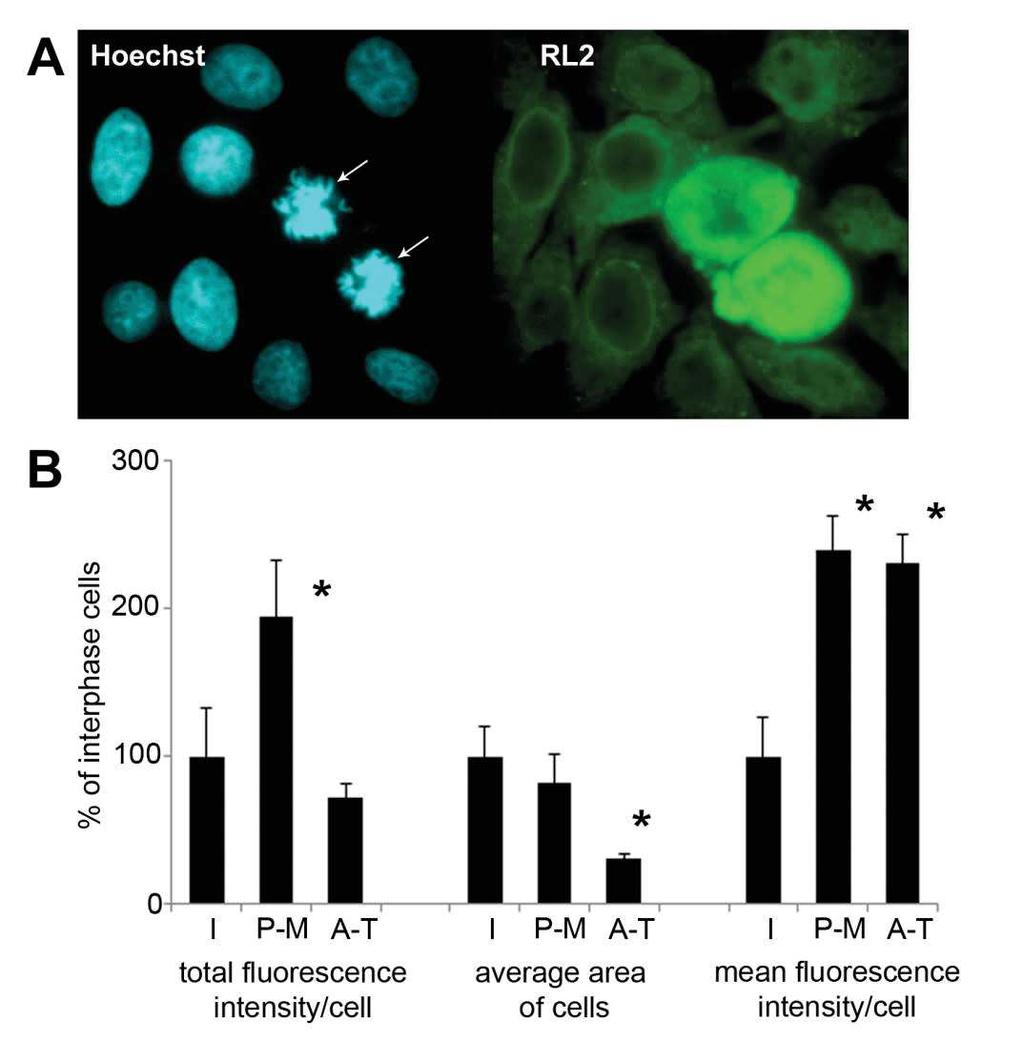 Molecules 2018, 23, 1275 7 of 16 Figure 5. Immunofluorescence shows dynamic protein O-GlcNAc regulation during mitosis.