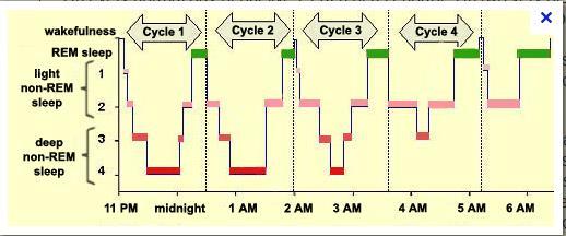 Normal hypnogram The cycle of REM and