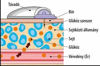 CGM I SZENZOROS GLÜKÓZSZINT (SZG) ÉS VÉRCUKORSZINT (VC) 10.