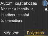 elkezdhessenek kommunikálni egymással. Ez teszi lehetővé, hogy a szenzorról érkező adatok megjelenjenek az inzulinpumpa képernyőjén.