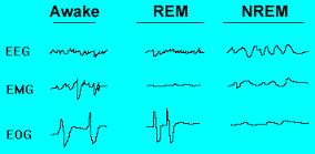 szemmozgások jellemezik, melyek szabad szemmel is láthatóak. Ezt nevezzük REM szakasznak, azaz gyors szemmozgások szakaszának.