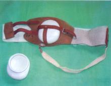 Stoma