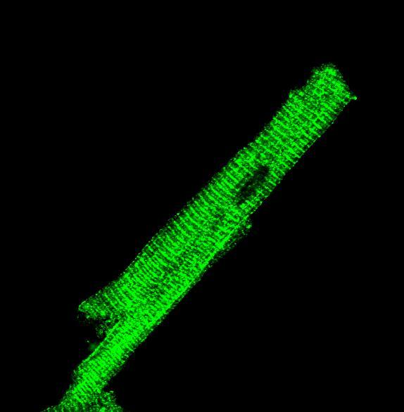A FELSZABADULÁSOK MÉRÉSE A sejteket feltöltjük fluoreszcens festékkel (Fluo-4AM) A festék köti a szabad, intracelluláris -ot Gerjesztőfény révén a kibocsájtott fluoreszcencia mérhető 1 Hz