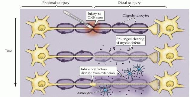Regeneráció a CNS axonokban