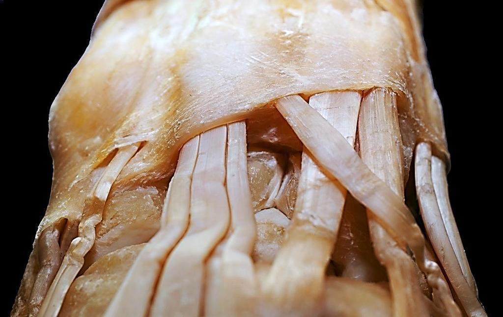 extensor digitorum et indicis 5. M.