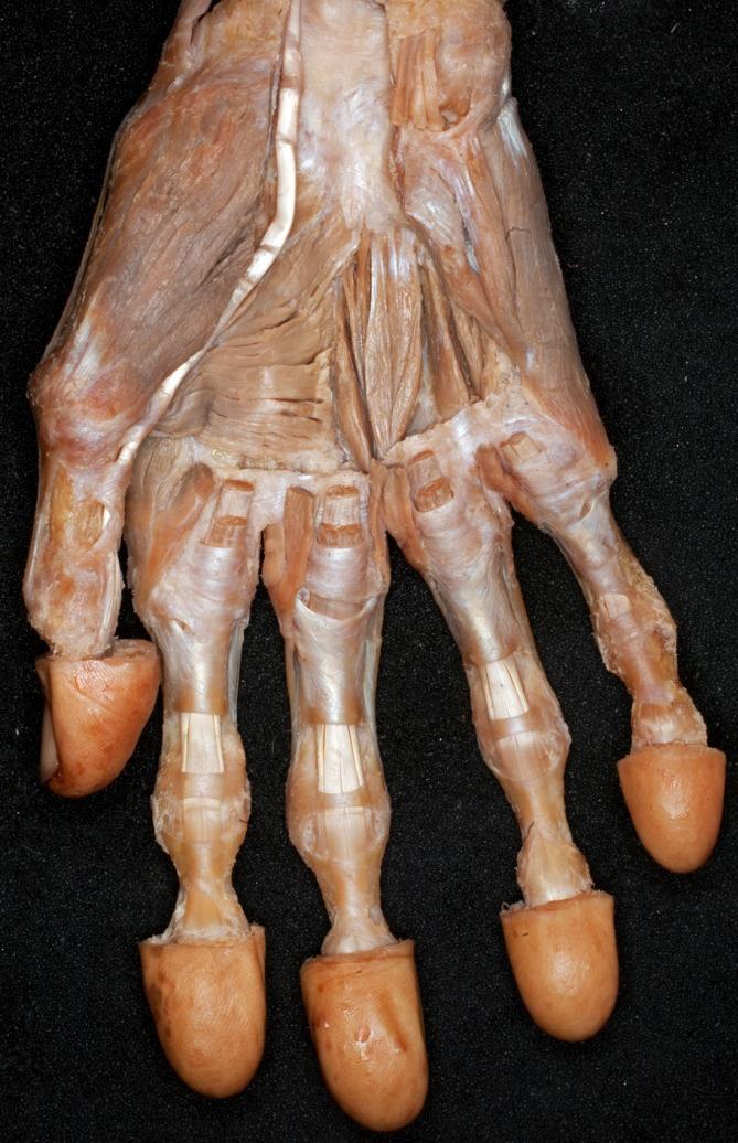 Thenar: Sobotta m. abductor pollicis m.