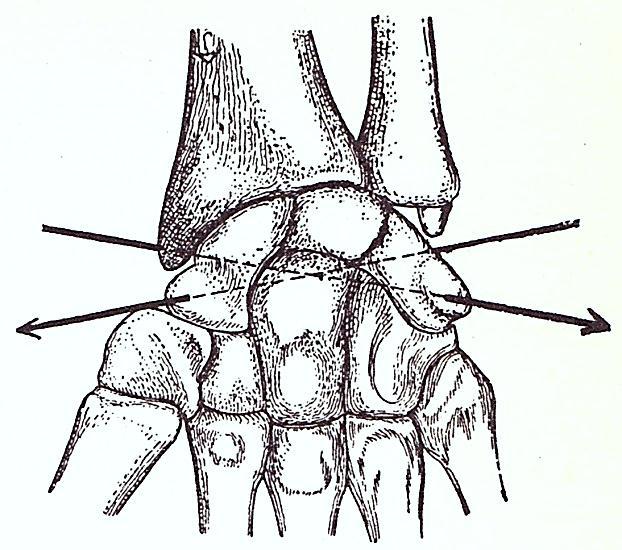 Thiel Articulatio intercarpea Kiss
