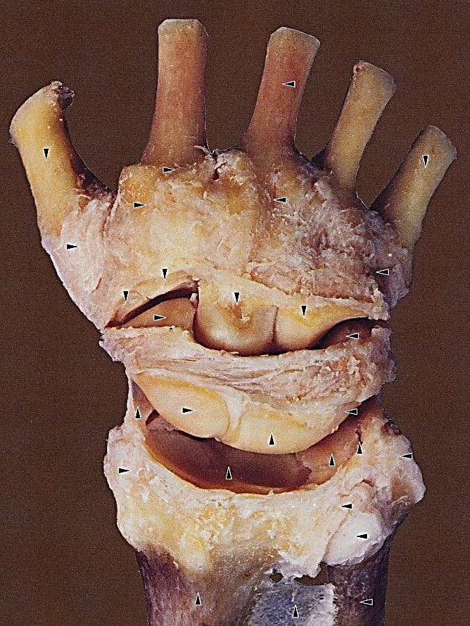 Articulatio mediocarpea / distalis