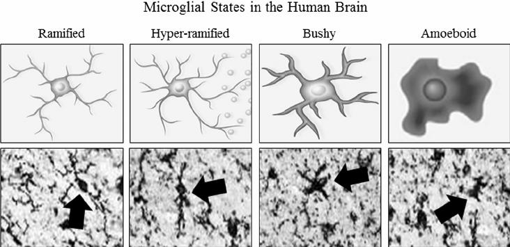 Idegrendszer: mikroglia Nyugvó állapot: Enyhe aktiváció: hosszabb elágazó nyúlványok citokin termelés