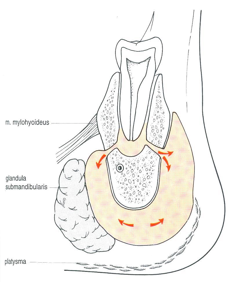 Subperiostealis