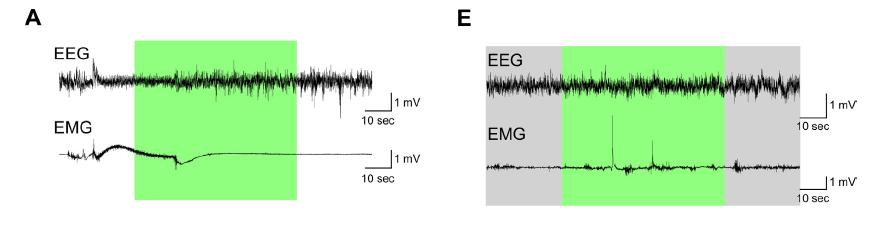 Behav Brain Res. 2013 Oct 15;255:64-74.