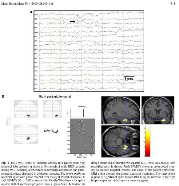 EEG-fMRI