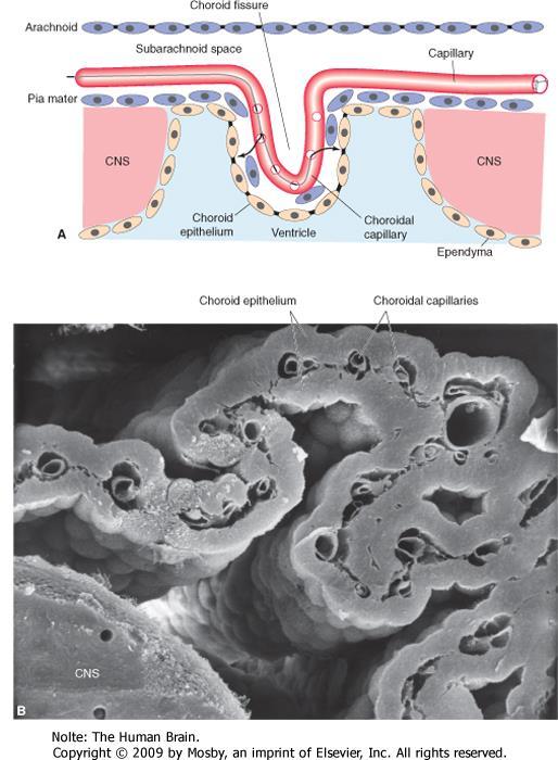 A choroid plexus