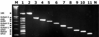 8.5. Multiplex RT-PCR Ez a módszer azért különösen nagy előrelépést jelent a diagnosztikában, mert amellett, hogy a PCR minden előnyével rendelkezik, számos vírus egyidejű kimutatására is alkalmas.
