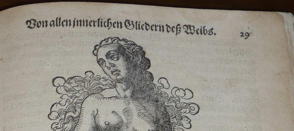 Ha megvizsgáljuk a 34. ábrát, láthatjuk, hogy egy szedercsíra-állapotú magzatot ábrázol. Az Albertus Magnus féle Hebamen Buch 22-26.