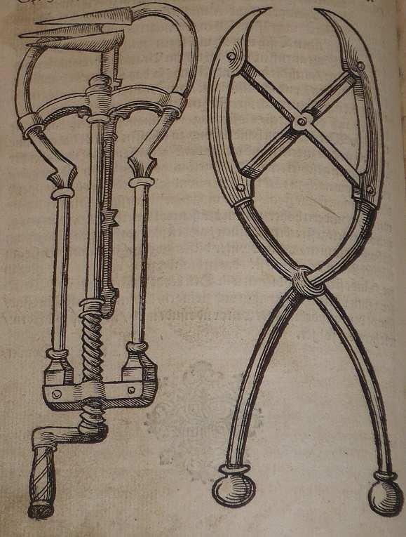 Most vizsgáljuk meg az orvosi könyvtárban feltárt Iacobi Rueff (Rueff, 1554) és Albertus Magnus (Magnus, 1581) féle munkákban fellelhető sebészeti, szülést segítő