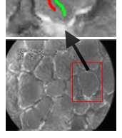 Nem közölt adatok Alveolus perfúziós ráta 0,7 0,6 * * 0,5 0,4 0,3 PEEP= 15