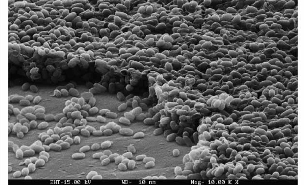 Clostridium difficile baktériumok elektronmikroszkópos felvétele A szobáját Clostridium difficile fertőzött betegtől átvevő beteg 50%-kal nagyobb valószínűséggel fertőződik meg maga is a Clostridium