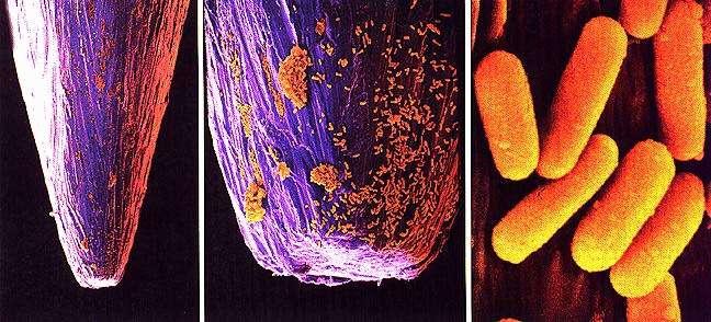 Mikrobiális biofilmek