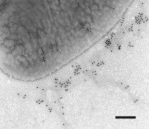 25-30, 2001 Immuno-golddal jelölt