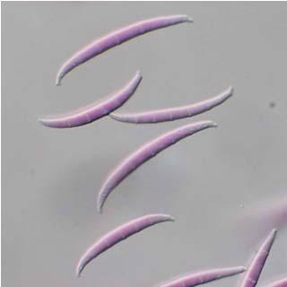 Deuteromycota Fusarium