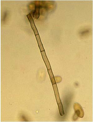 Tenyésztest: Válaszfalas hifa a tömlősgombákkal megegyezően - álharántfalas, mivel zömükben az Ascomycota-val állnak anamorf-teleomorf (ivartalan ivaros) kapcsolatban Növénykórtan 5 - Mikológia 5 5