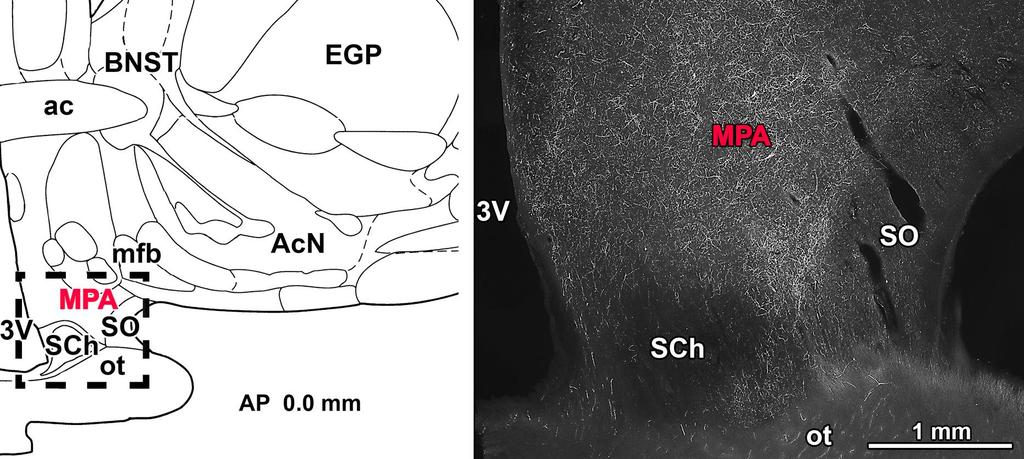 PTH2 RECEPTOR IMMUNREAKTIVITÁS A HUMÁN PREOPTIKUS TERÜLETEN Bagó A.G., Dimitrov E., Saunders R., Seress L., Palkovits M., Usdin T.B., Dobolyi A.