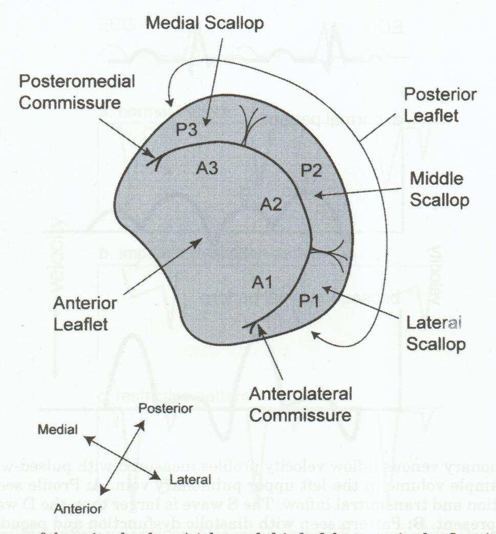 a bal kamra geometriája, ami fontos a bal kamra