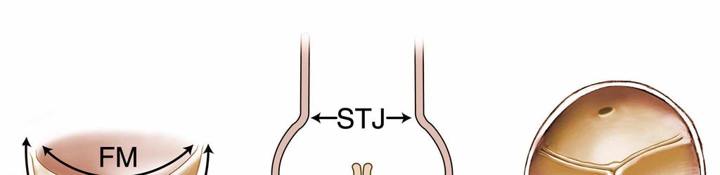 Aorta