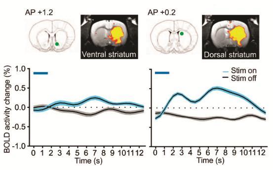 KÖZÉPAGYI DOPAMINERG NEURONOK OPTOGENETIKAI STIMULÁLÁSA AKTIVÁLJA A STRIATUMOT - fmri Emily A. Ferenczi et al.