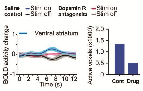 DOPAMINERG RECEPTOR ANTAGONISTA MEGAKADÁLYOZZA A STRIATUM AKTIVÁLÓDÁSÁT Emily A. Ferenczi et al.