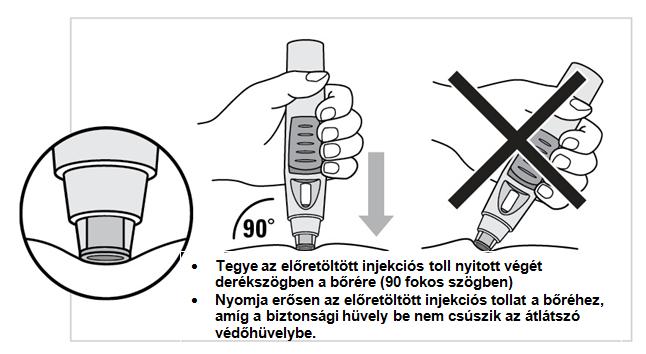 Két beadási módszer közül választhat. A bőr összecsípése nélküli beadás javasolt (5.a ábra).