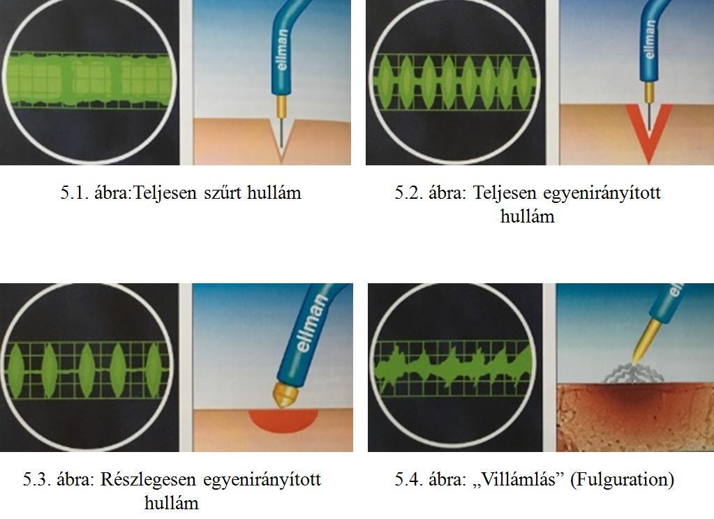 A teljesen egyenirányított hullámforma pillanatnyi pulzatív hatást hoz létre, mellyel a vágó hatás kissé mérséklődik.
