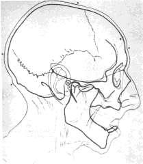 al. 1998, Ubelaker & O Donnell 1992, Vanezis et al.